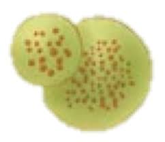 Lysosomes By Sandra Schaedler Infographic Create a transparent png pixels base64 encoded.