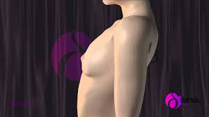 Maybe you would like to learn more about one of these? Aumento De Pecho En Clinicas Dorsia Youtube