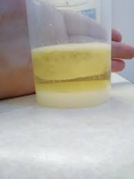 Salt Test Trying To Conceive Forums What To Expect