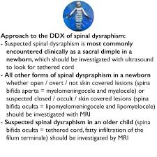 Image result for Dysraphism