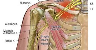 Treating Pinched Nerves Medical Massage Massage Therapy Muscle Anatomy