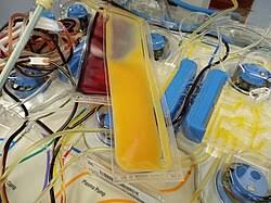 Image result for Apheresis