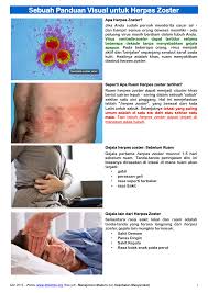 Create and optimise schedules and send to staff in minutes. Sebuah Panduan Visual Untuk Herpes Zoster