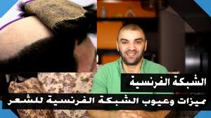 مميزات وعيوب وتاثير الشبكة الفرنسية وتركيب الشعر الثابت على فروة الرأس Hair Incoming Call Screenshot Incoming Call