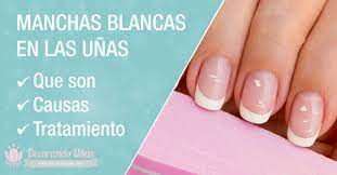 We did not find results for: Https Xn Decorandouas Jhb Net Manchas Blancas En Las Unas Leuconiquia