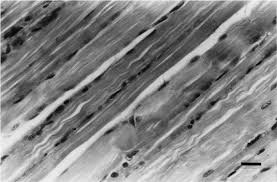 A- Longitudinal section of control mouse gastrocnemius muscle. Bar...