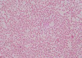 They are characterized by their cell envelopes, which are composed of a thin peptidoglycan cell wall sandwiched between an inner cytoplasmic cell membrane and a bacterial outer membrane. Gram Negative Bacilli Stock Image Image Of Infection 130658161