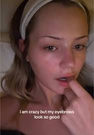 #crazy #foreheadreveal