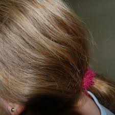 Descriptions of their color vary, but generally they lice eggs (called nits) are oval in shape. What Do Lice Look Like Pictures Of Nits Eggs And Lice