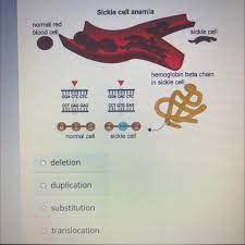 This can cause painful swelling in the feet and hands, as well as fatigue and jaundice. Select The Correct Answer Sickle Cells Disease Is A Here Ditary Mutation That Causes The Red Blood Brainly Com