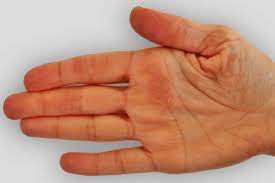 Dreaded orange spots can appear on cold process soap while curing, or months after it has been made. These Are The Diseases Your Hands Can Predict The Healthy