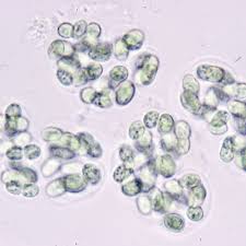 Image result for Scleria globonux