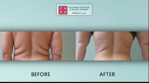 Columbus aesthetic and plastic surgery is a medical group practice located in upper arlington, oh that specializes in nursing (nurse practitioner) and . Daytime Columbus Aesthetic Plastic Surgery Youtube