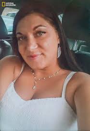 Amazing face transplants (GRAPHIC IMAGES)