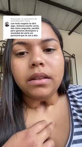 Respuesta a @Jose Benjamin Tovar mi humilde opinión @ZUNI Carrero 🙏🏼