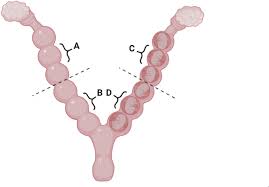 Image result for Pink 1983 Caloric