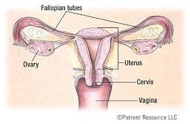 Postoperative treatment of ovarian cancer depends on the stage and grade (see table postoperative treatment of ovarian cancer by stage and type). Patient Resource Publishing Ovarian Cancer