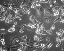 Image of SNU523 cell line