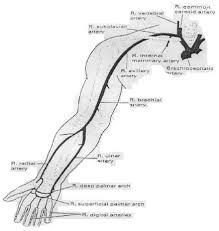 Image result for Difficult Intravenous Access in Children