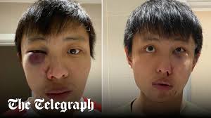 Oxford Street 'Covid' attack