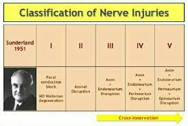 Consists of 5 degrees of injury (further stratifying the extent of endo/peri/epineurium. Nerve Injuries 01 Sunderlands Classification Ortho Classification Medicine