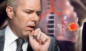 Here's a quick rundown of the signs. Lung Cancer Symptoms Signs Of Tumour You Need Treatment Include A Bad Cough Express Co Uk
