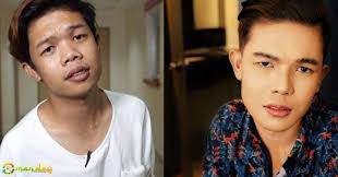 425,818 likes · 73,921 talking about this. Xander Ford S Face Began To Return On Its Original Form Few Months After Surgery