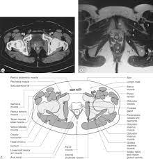 Maybe you would like to learn more about one of these? The Pelvis Radiology Key