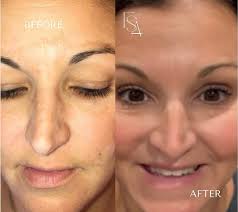 We're so close to welcoming you all to our beautiful new location! The  countdown begins! 💉🤍