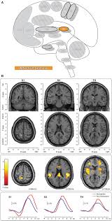 Image result for Eye Rest Green 1977 Hussmann