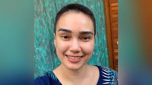 Bagi wanita, rambut bagaikan mahkota. Seperti Feby Febiola Kenapa Kemoterapi Bikin Rambut Rontok Cantik Tempo Co