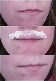 It contains vitamin c which helps to bleach the skin easily. Bleach To Bare With Jolen 200 Ulta Gift Card Giveaway Closed Upper Lip Hair Organic Skin Care Diy Skin Bleaching