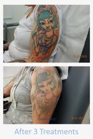 For more tattoo related content you can check out my other channel here: Fading This Brightly Coloured Tattoo Required Only Tattoo Laser Colour Sleeve Transparent Png 1012x1488 Free Download On Nicepng