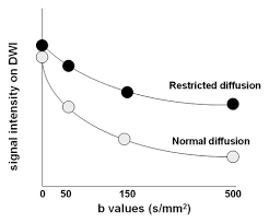 Diffusion Weighted Imaging In The Abdomen And Pelvis Concepts And Applications Radiographics