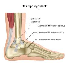 Fussluxation Und Distorsion Verrenkung Und Verstauchung