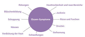 Information and translations of ekzeme in the most comprehensive dictionary definitions resource on the web. Ekzeme Ratgeber I Hilfe Behandlung