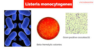 Listeria monocytogenes in gram stain showing gram positive coccobacillus, small gram rod to large rod and also in groups resembling diphtheroids.#listeria#gr. Listeria Monocytogenes Properties Pathogenesis Lab Diagnosis Microbe Online