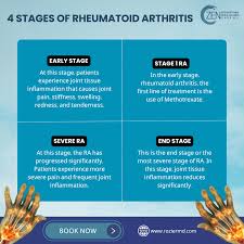 Image result for Rheumatoid Factor
