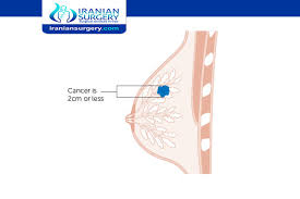 One in seven men in the united states will receive a prostate cancer diagnosis during his lifetime. Stage 1 Breast Cancer Treatment For Breast Cancer Stage 1