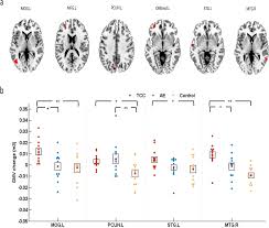 We did not find results for: Tai Chi Chuan Vs General Aerobic Exercise In Brain Plasticity A Multimodal Mri Study Scientific Reports