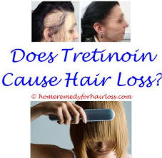 One female subject with pronounced alopecia for more than 20 years had regrowth of hair using only tretinoin for a period of 18 months. Pin On Hair Loss Remedy