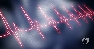 Understanding Sick Sinus Syndrome Oklahoma Heart Hospital