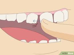 Generell gilt hierbei der erhaltungsgrundsatz. Einen Zahn Schmerzlos Ziehen 11 Schritte Mit Bildern Wikihow