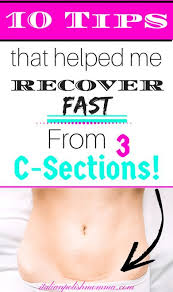 C Section Recovery Tips C Section Recovery Breastfeeding C Section