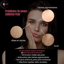 Sara Boucher (@diaderma_7) • Instagram photos and videos