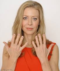 Your hands quickly betray your age but are risky to tamper with  cosmetically