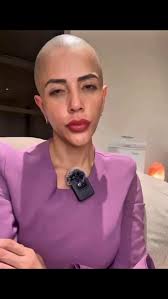 90 Day Fiance Star Jasmine responds to the h@teful comments stating that  she’s using her “alopecia” for attention‼️ 👒🥲 #90dayfiance