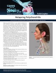 Image result for Relapsing Polychondritis