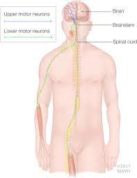 Abstract—heart disease is the leading cause of death in the world over the past 10 years. Amyotrophic Lateral Sclerosis An Update For 2018 Mayo Clinic Proceedings