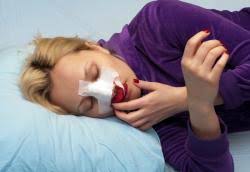 Therapie Eines Nasenbeinbruchs